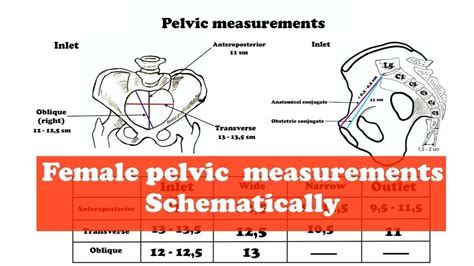 The Female Bony Pelvis Measurements - YouTube