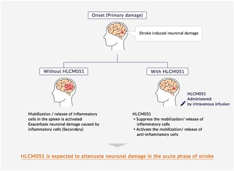 Ischemic stroke | Healios K.K.