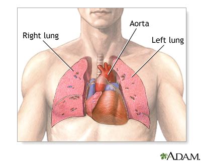 Heart-lung transplant - series—Normal anatomy: MedlinePlus Medical ...