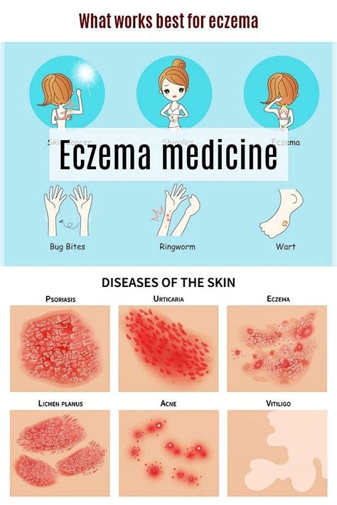 Stages Of Eczema