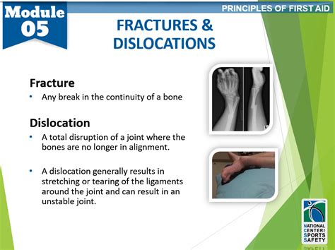 23-fractures-and-dislocations – National Center for Sports Safety