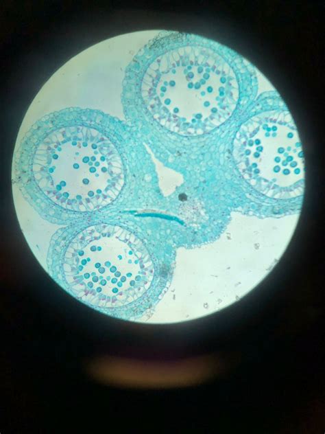 Angiosperm Lily Anther - Pollen Tetrads Diagram | Quizlet