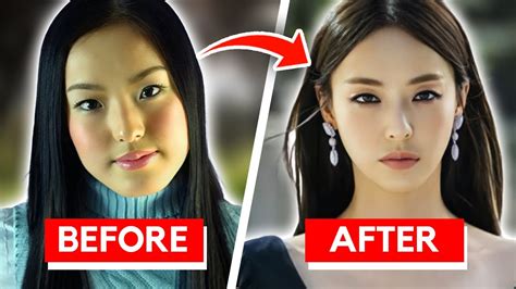 Korean Artist Plastic Surgery Before And After