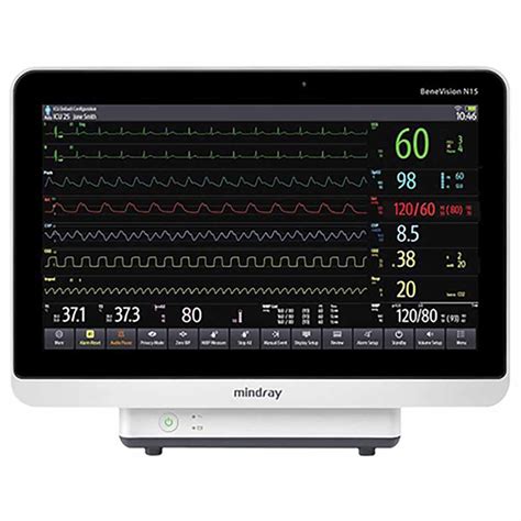 Mindray BeneVision N15 Patient Monitor | Quince Medical & Surgical