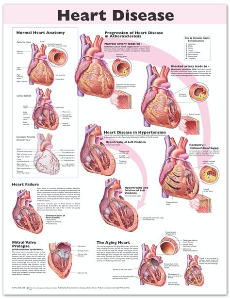 Reference Chart - Heart Disease - Biologyproducts.com