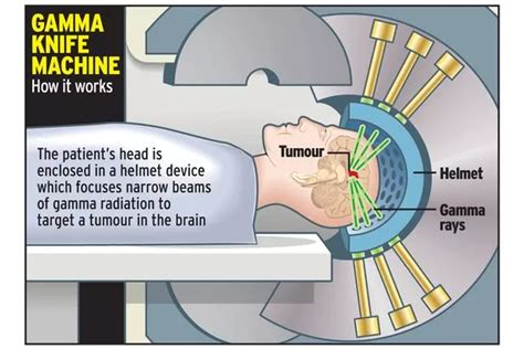 Hundreds of desperate cancer patients BANNED from hi-tech life-saving cure - Mirror Online