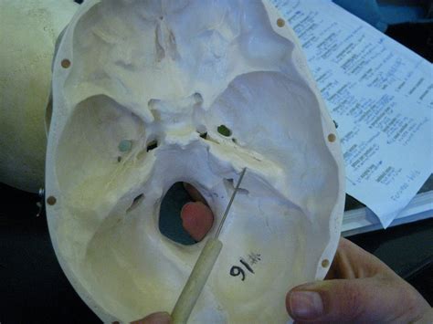 Boned: Human Skull - petrous part (of temporal bone)