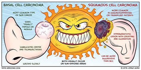 Basal Cell Carcinoma Vs Squamous Cell Carcinoma