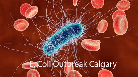 E. Coli Outbreak Calgary 2024 6 Calgary daycares, 5 Other Area Sites More Details - Orange BYBK