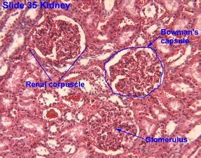 Irresti: Cortical Region Of Kidney