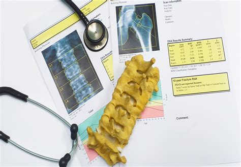 What is a Bone Density Scan? | ImageCare Centers