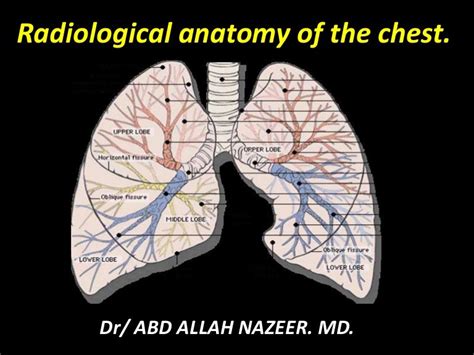 Presentation1.pptx, radiological anatomy of the chest.