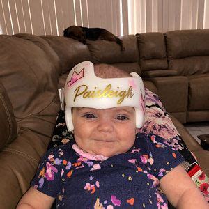 Baby Helmet Cranial Band Decals Fixing My Crown and Dot | Etsy | Baby helmet, Helmet design ...