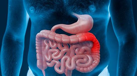 What Causes Intestinal Ischemia? – NutritionFact.in