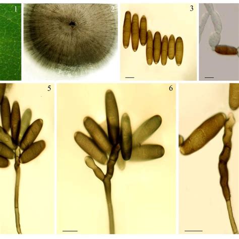 Bipolaris spicifera. 1 Symptoms developed on in vitro inoculated... | Download Scientific Diagram