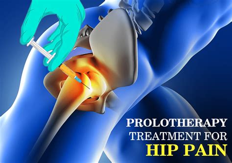 Hip Pain in People - Arthritis and Joint Degeneration