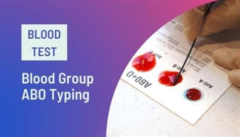 Blood Group Test: Type, Home Kit, Sample Report & Price [2025]