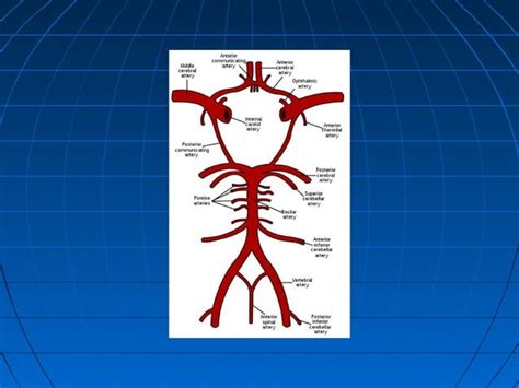 Hemiplegia stroke