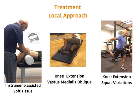 Patellofemoral Pain Syndrome Explained - Part II - Atletikka