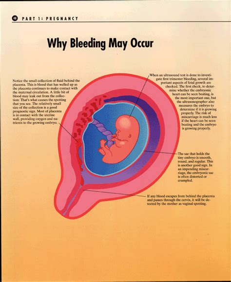 First Trimester Bleeding image 1