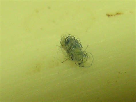 Bed Bug Eggs On Skin | BangDodo