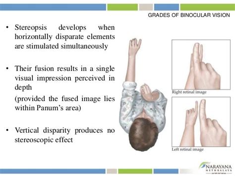 Binocular vision