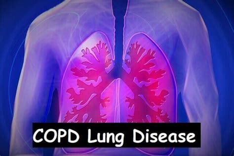 COPD Lung Disease: Causes, Symptoms, Examination, And Prevention