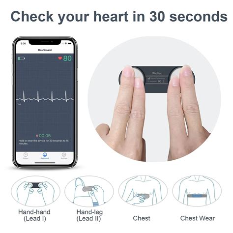 Máy Ghi Điện Tim Cầm Tay ECG EKG - Minh Uy Equipment Co.,Ltd