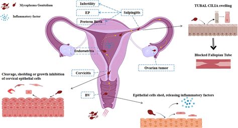 Frontiers | Mycoplasma genitalium infection in the female reproductive ...