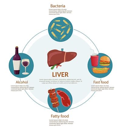 Causes Of Liver Disease Infographics Medical Background Illustration ...