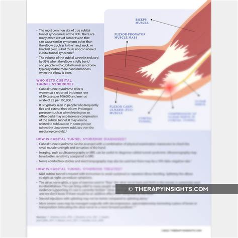 Cubital Tunnel Syndrome: Anatomy and Treatment – Adult and pediatric ...