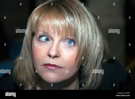 Cross eyed lady with Esotropia a lazy eye that looks in towards the nose Stock Photo - Alamy