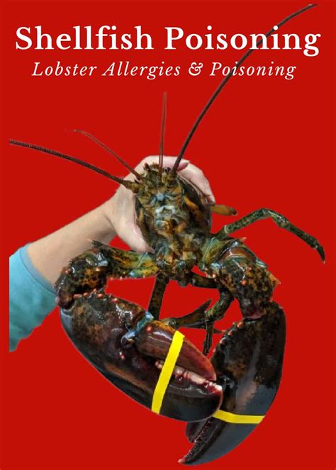 Lobster Poisoning: Can Lobster Make you Sick?