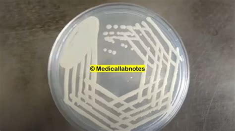 Candida treatment guidelines Archives - Medical Notes