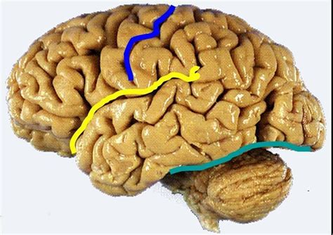 Lab 4: Brain Deep Fissures Diagram | Quizlet