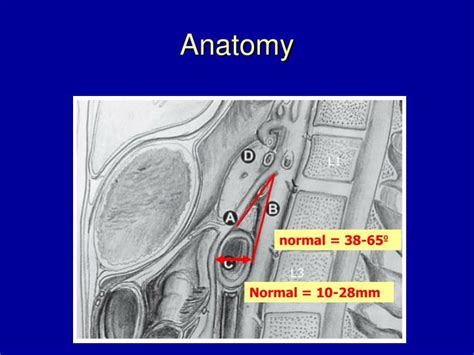 PPT - Superior Mesenteric Artery (SMA) Syndrome PowerPoint Presentation ...