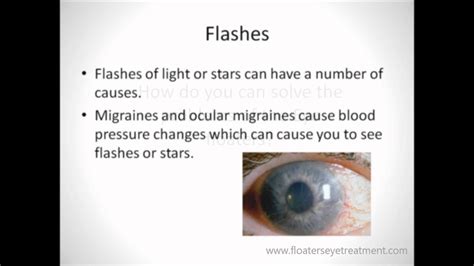 Light Flashes In Eyes And Floaters | Shelly Lighting