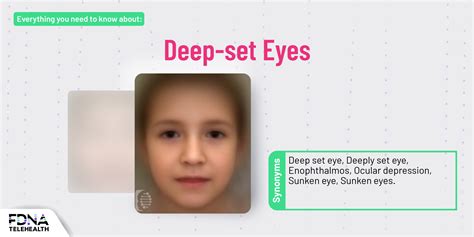 What causes deep-set eyes? Symptoms of a rare disease