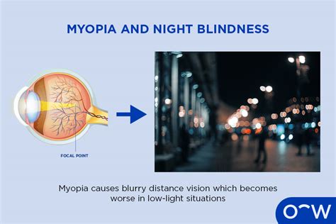 What is Night Blindness (Nyctalopia): Causes, Symptoms and Treatment