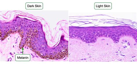 Histology Of Skin Lab