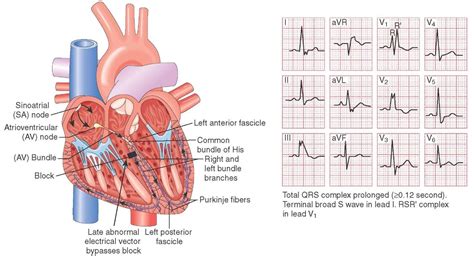 Pin op Cardiologie