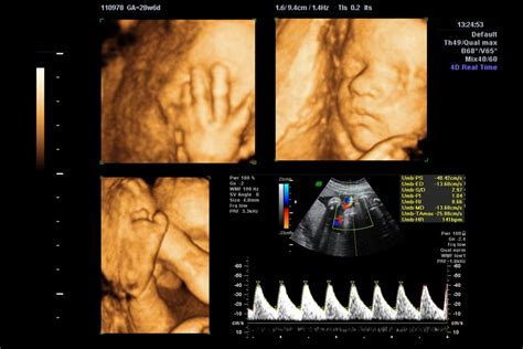 Ultrasound | Dourron OB/GYN & Associates