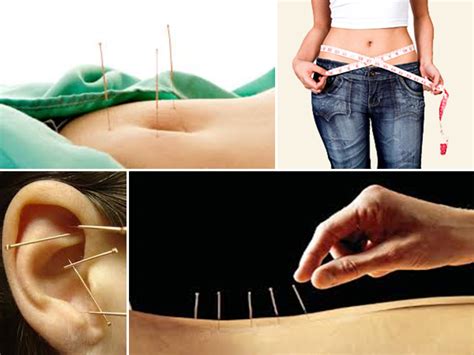 Weight Loss Acupuncture: Study Reports 5% Weight Loss in 8 Weeks. More ...