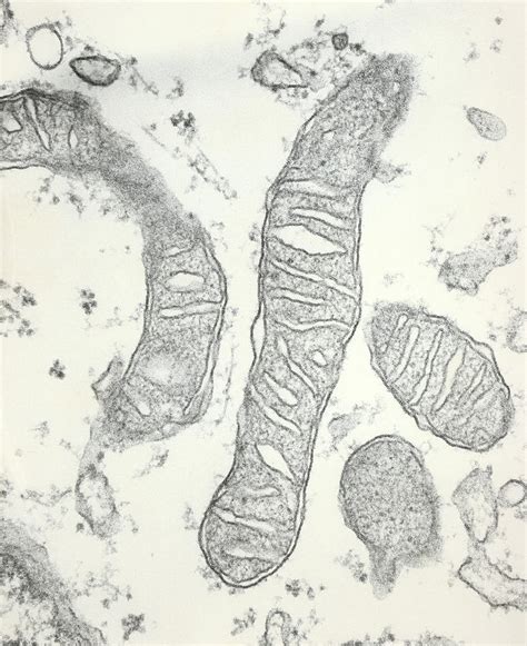 Transmission Electron Micrograph Of Mitochondria Photograph by Dr Gopal ...