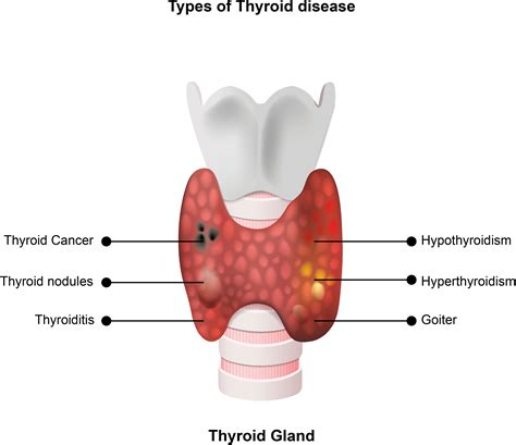 Frontiers | New biomarkers: prospect for diagnosis and monitoring of ...