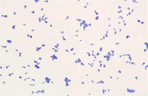 Corynebacterium Diphtheriae Shape | www.imgkid.com - The Image Kid Has It!