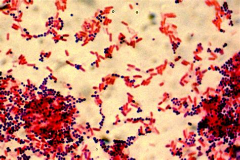 Gram-negative Bacteria Structure