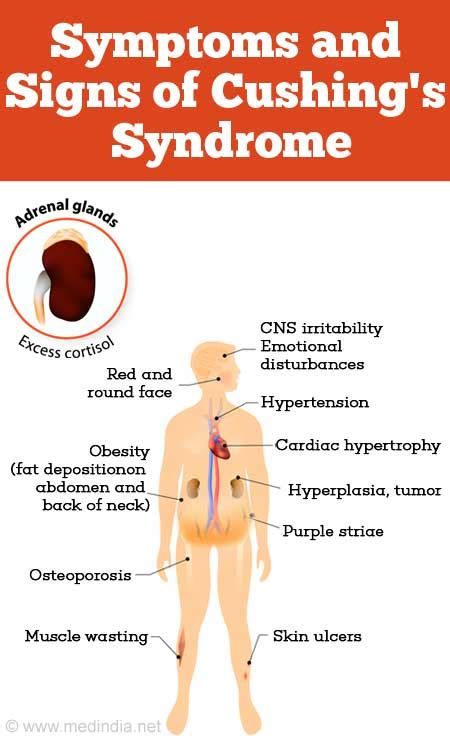 Pictures Of Cushing Disease - Pregnant Center Informations