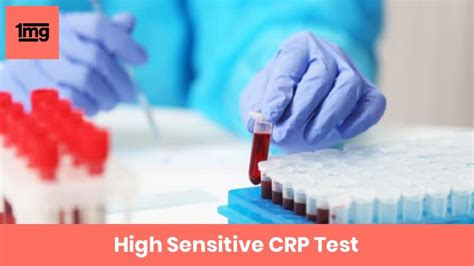 High Sensitive CRP (hsCRP): Purpose & Normal Range of Results | 1mg