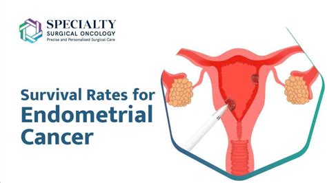 Survival Rates for Endometrial Cancer | SSO Hospital